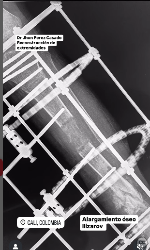 case image