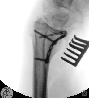 case image