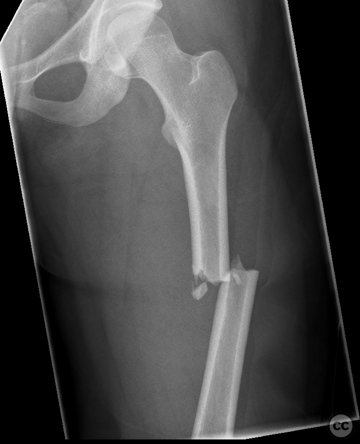 case image