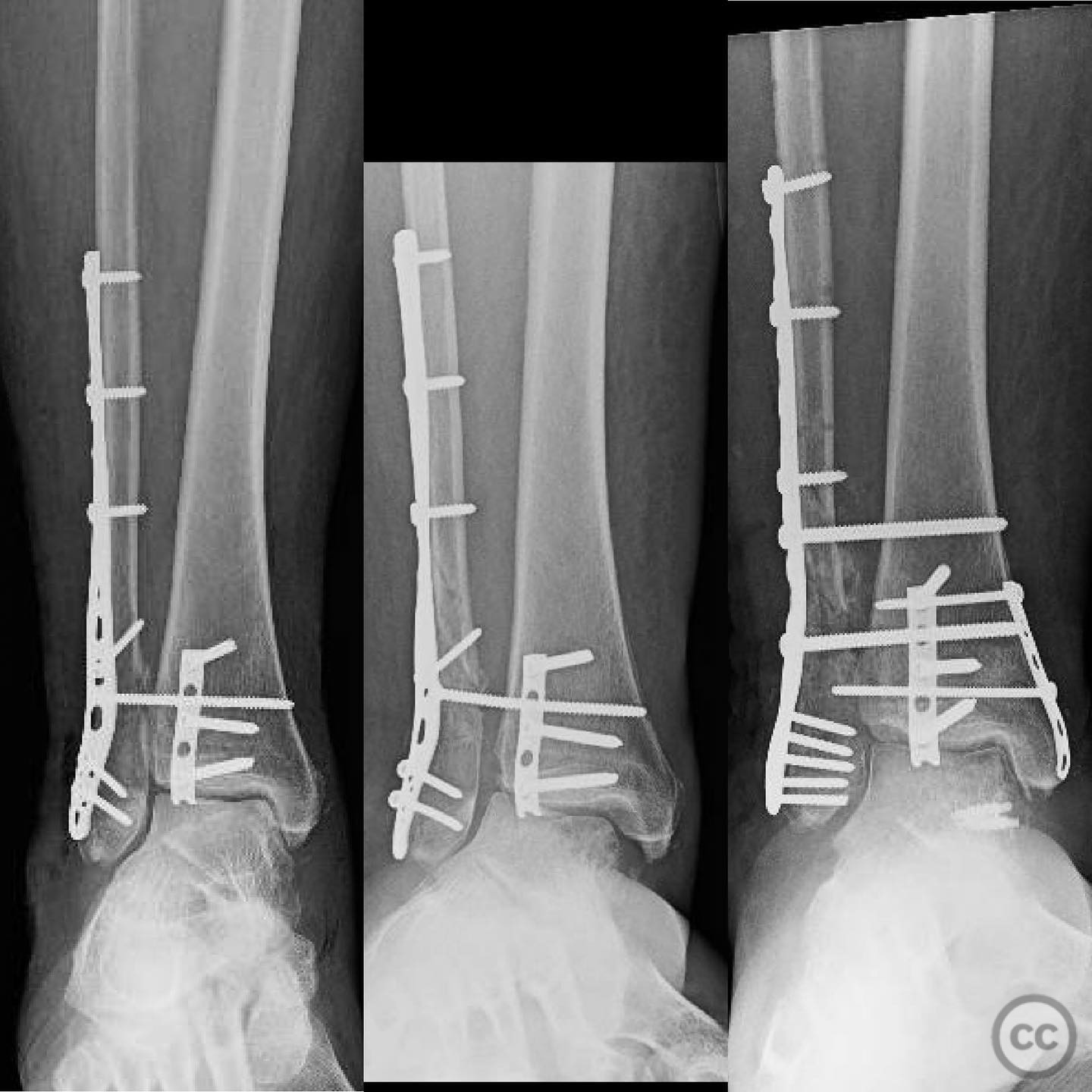 case image