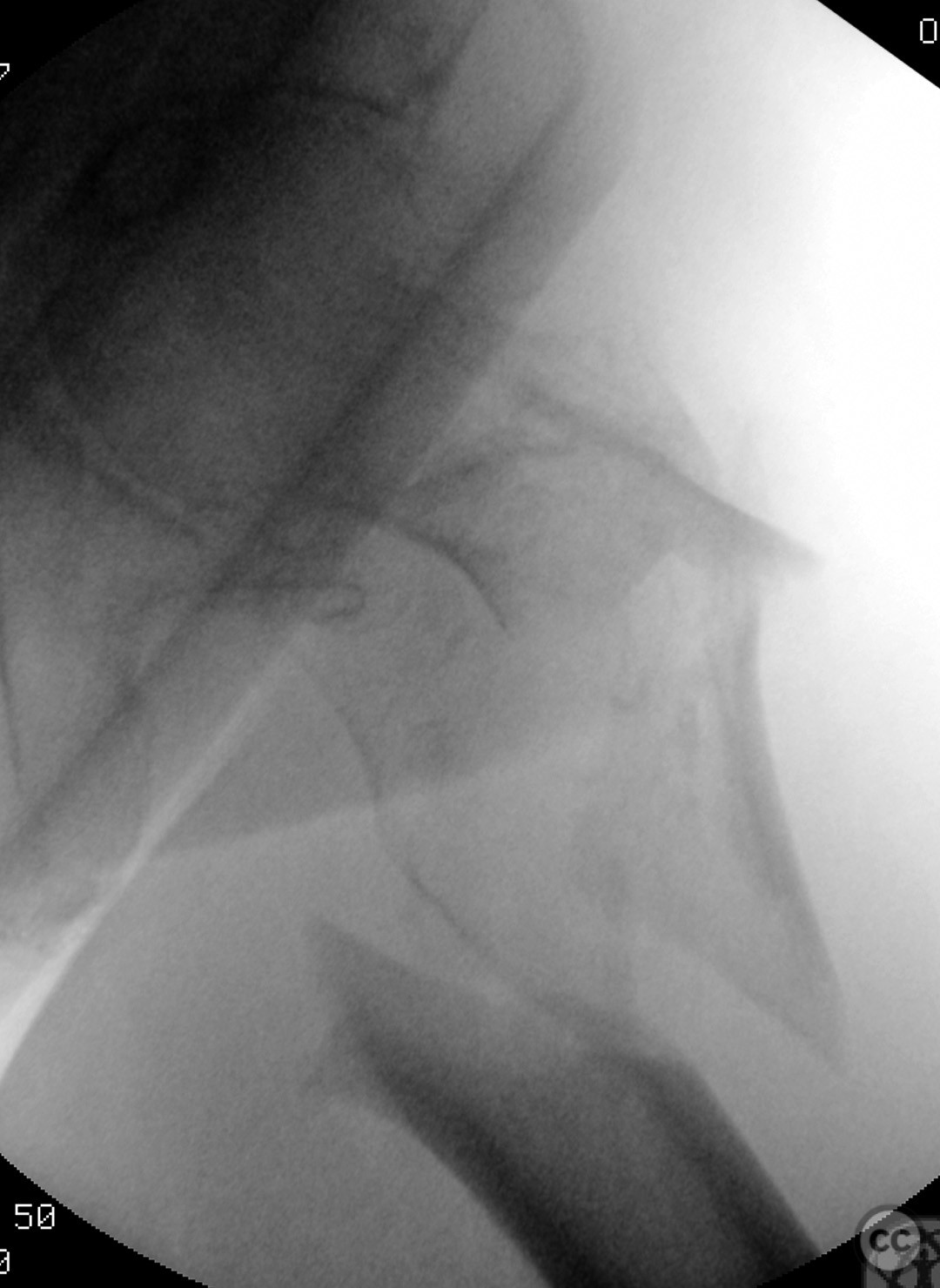 case image