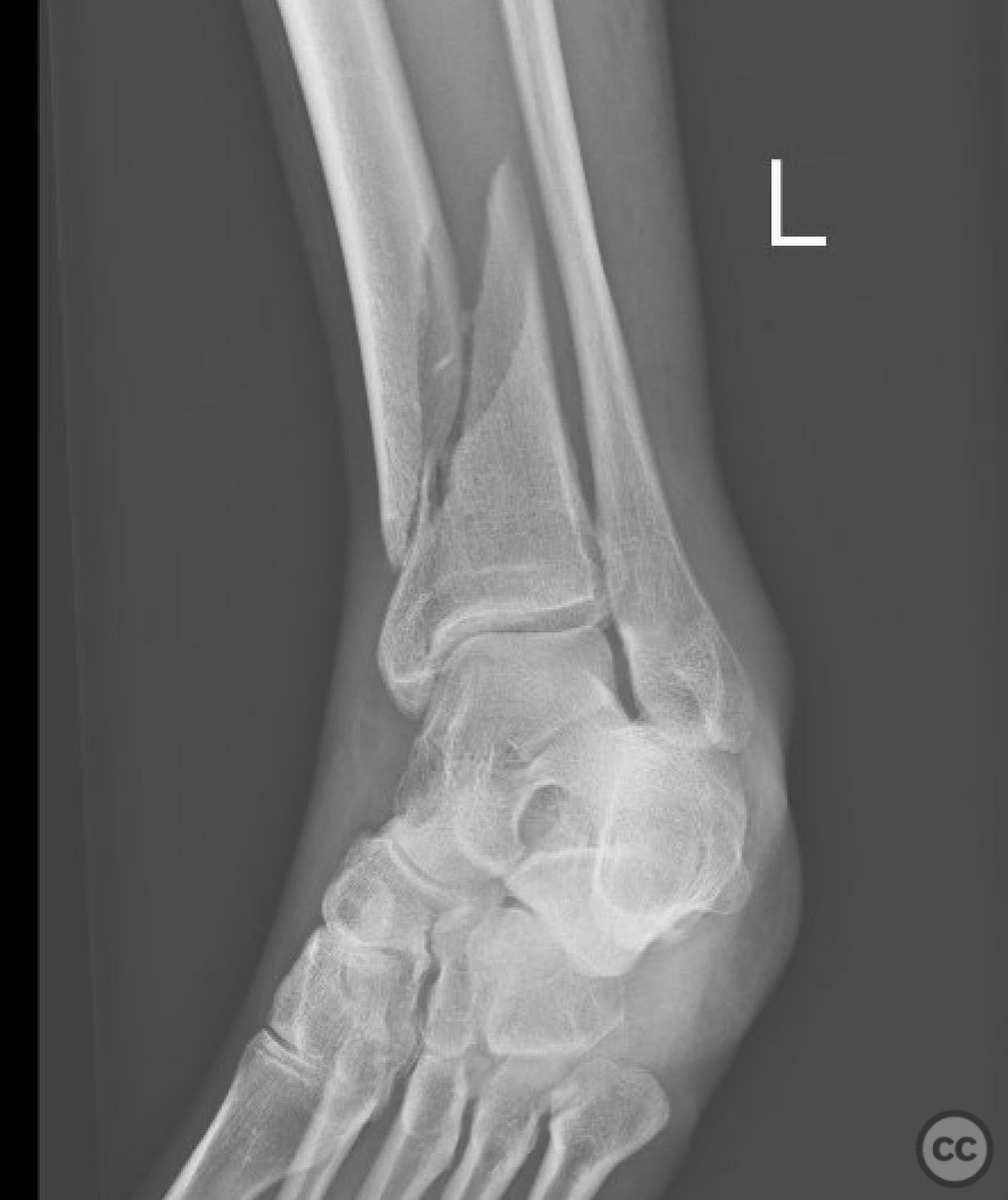 case image