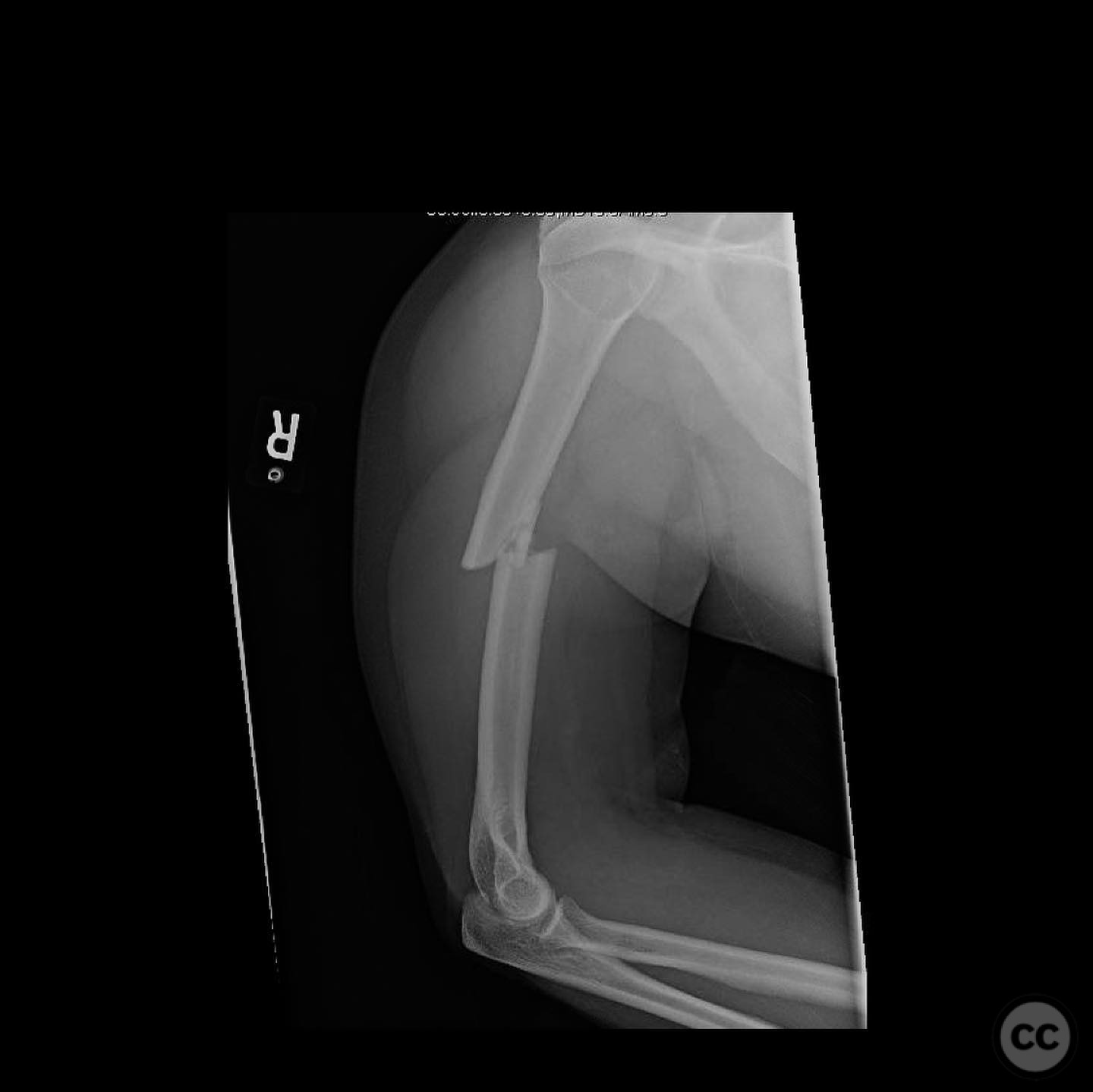 case image
