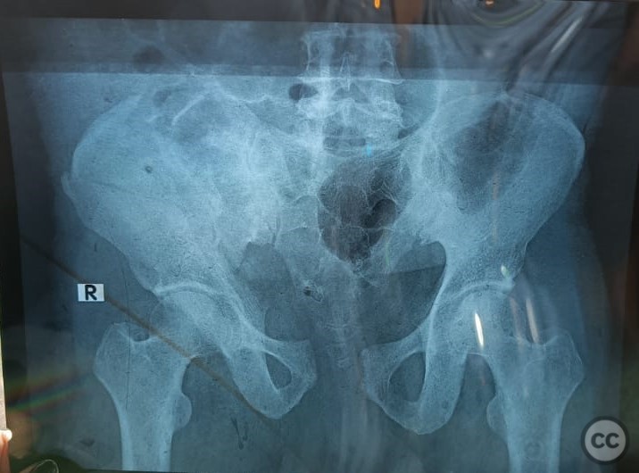case image