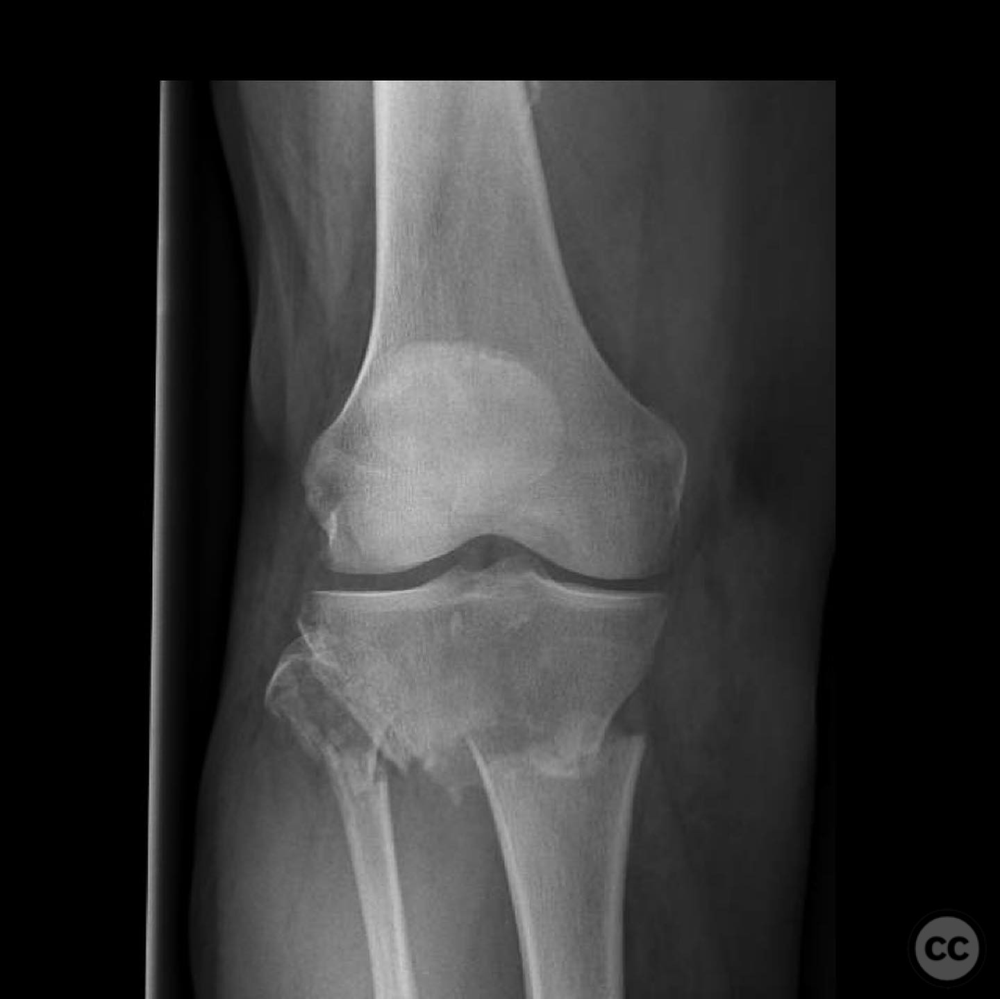 case image