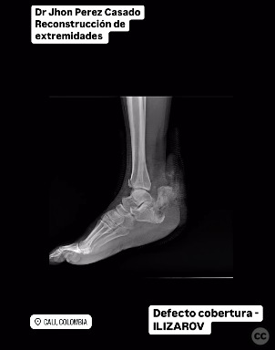 case image