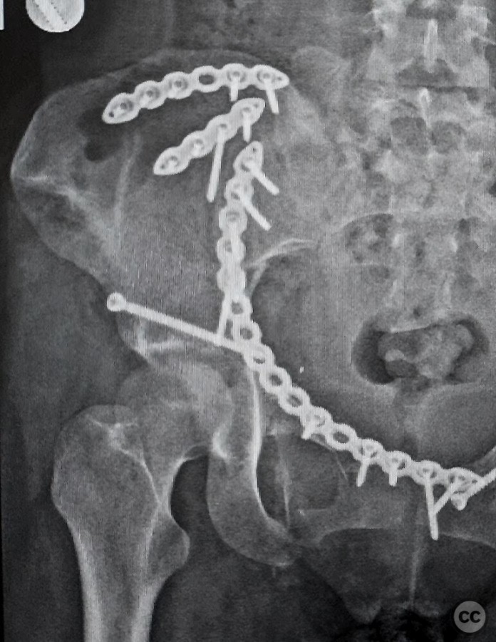 case image