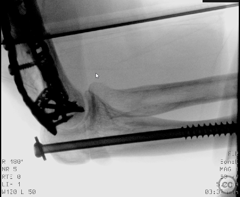 case image