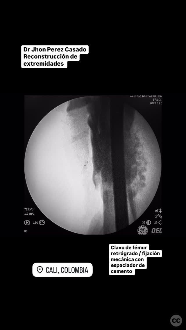 case image