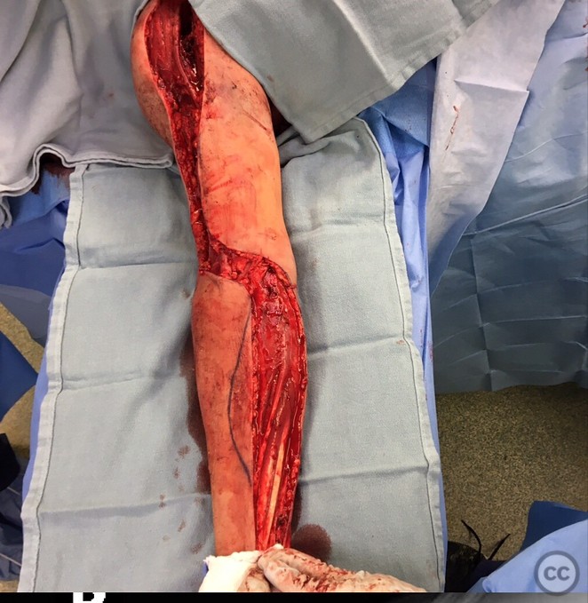 case image