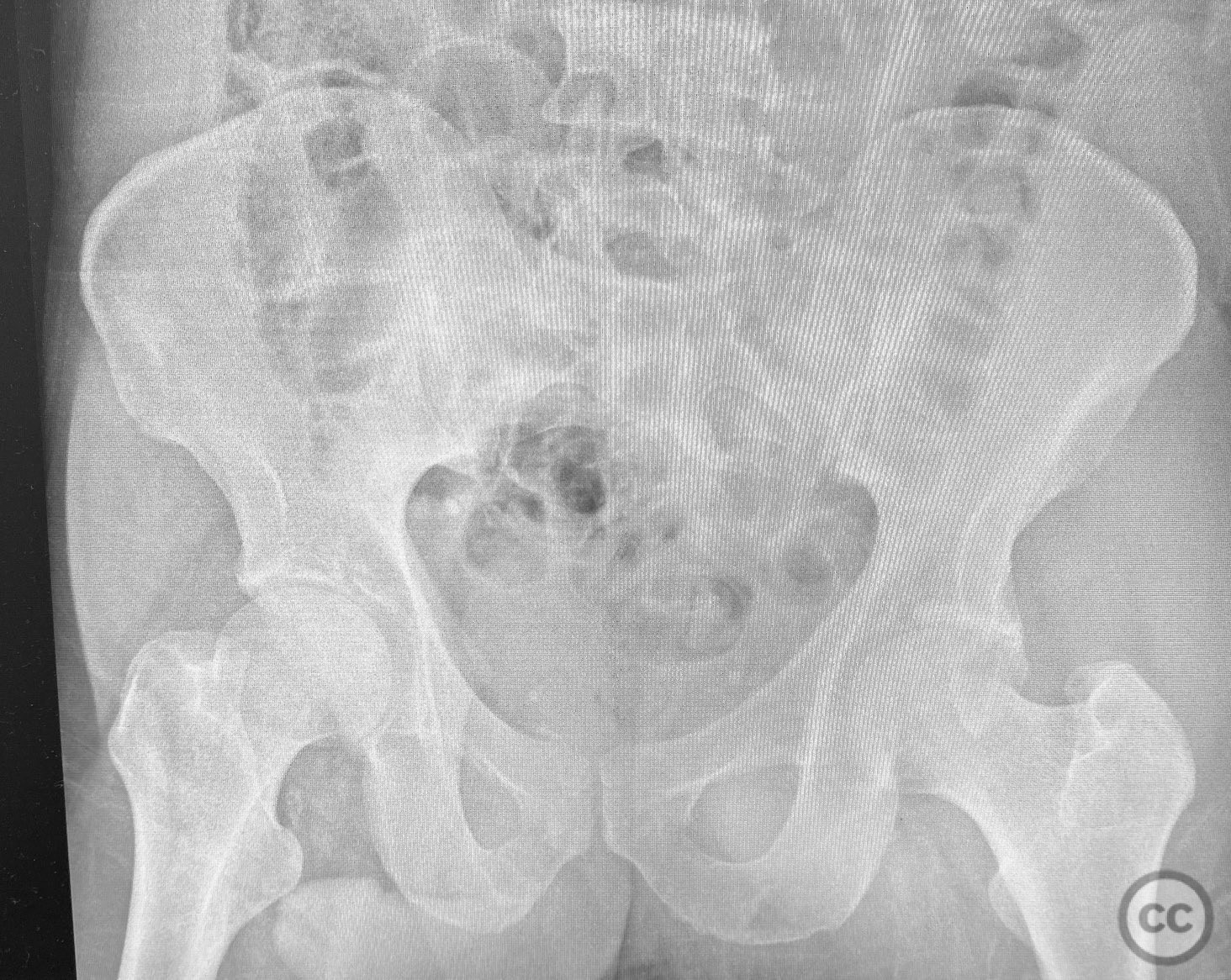 case image