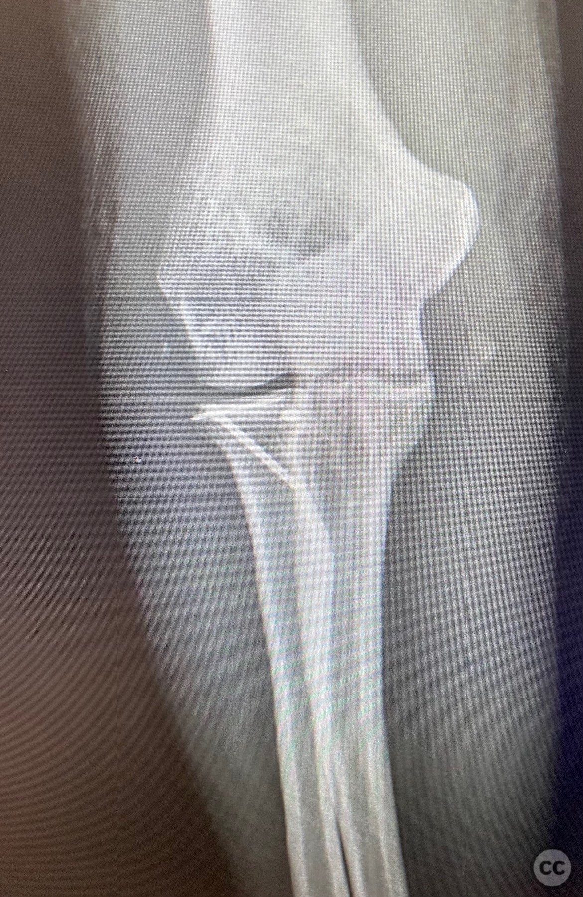 case image