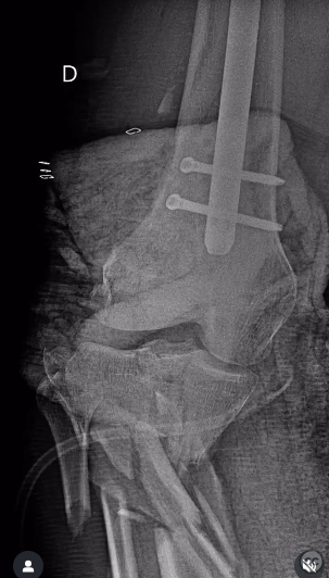 case image