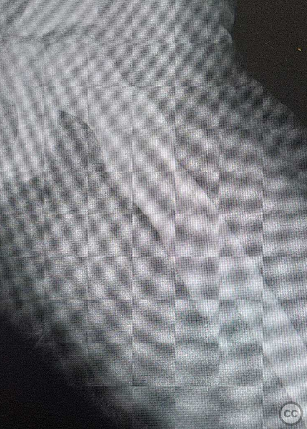 case image