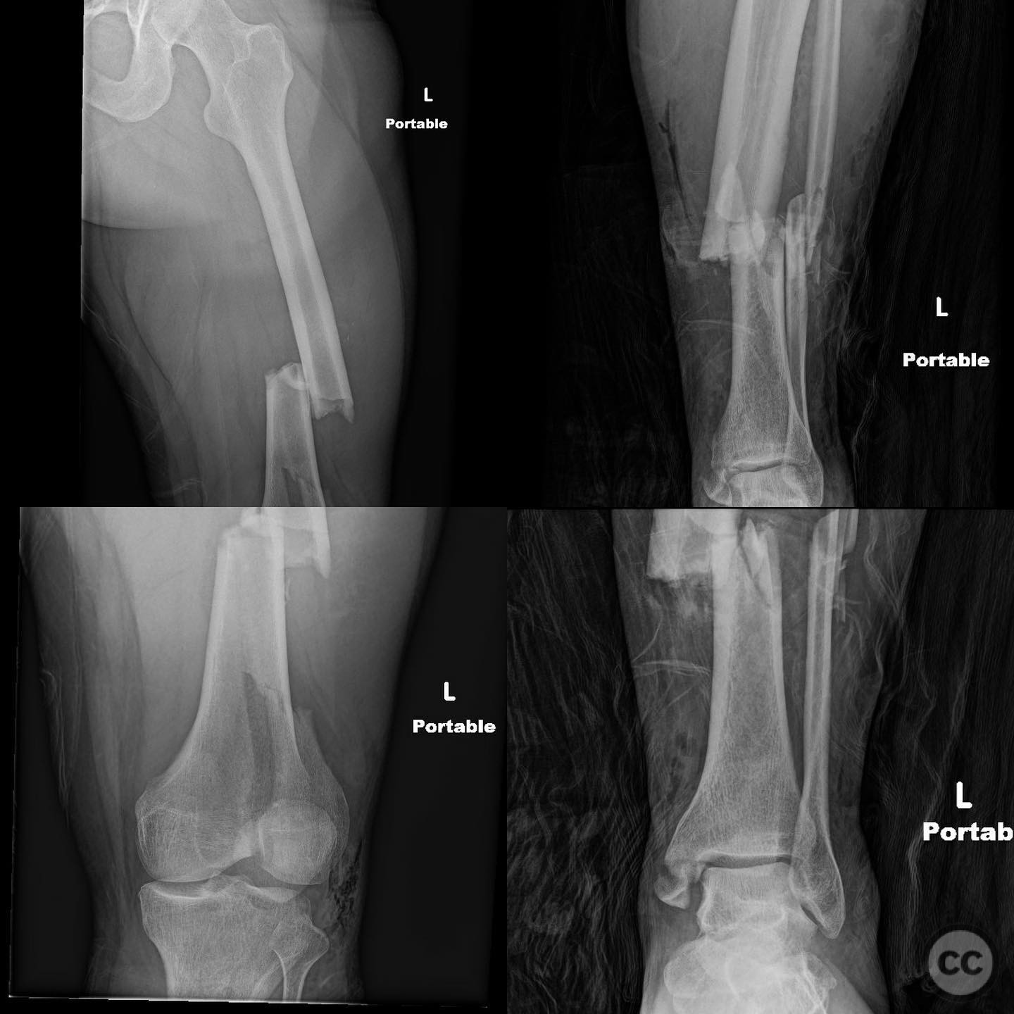case image