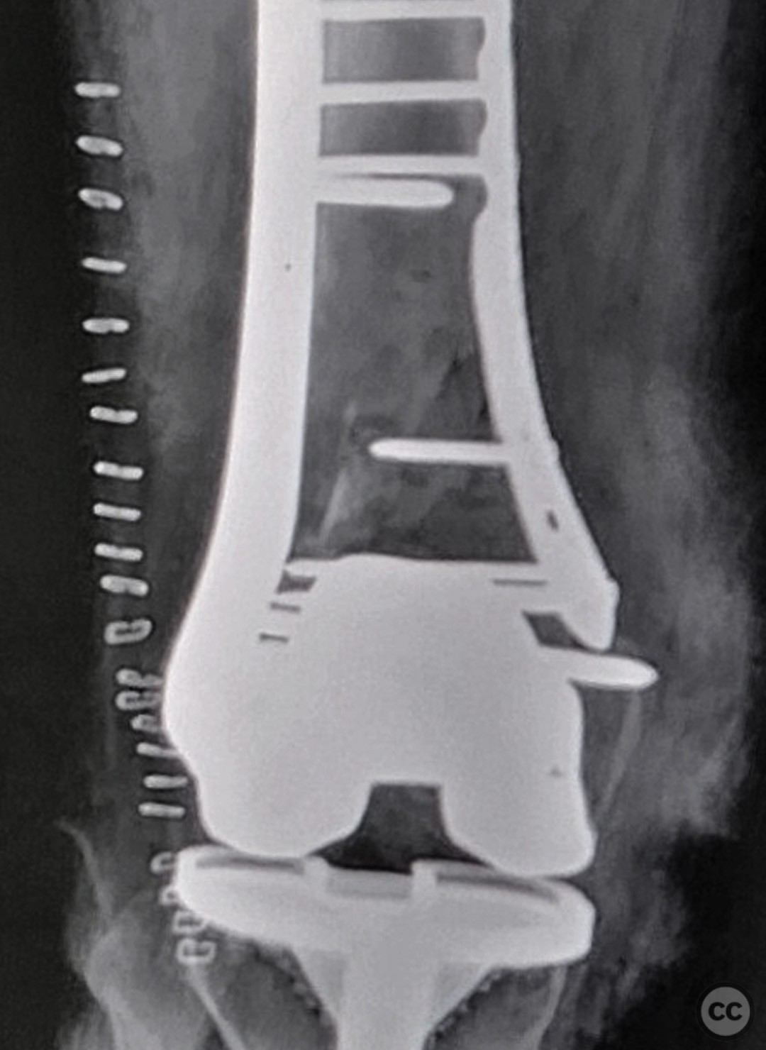 case image