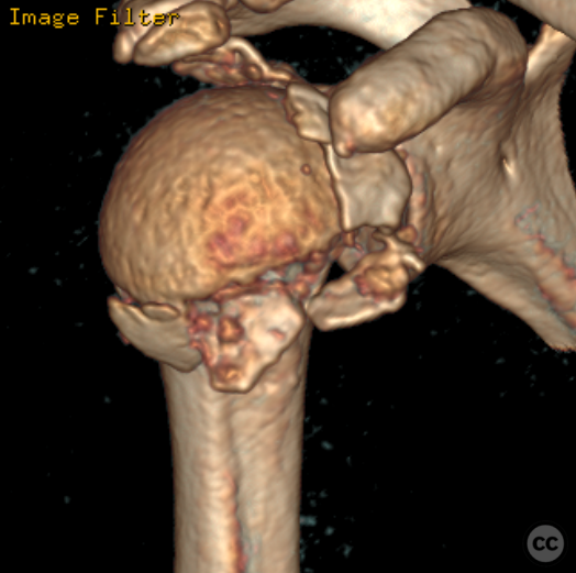 case image