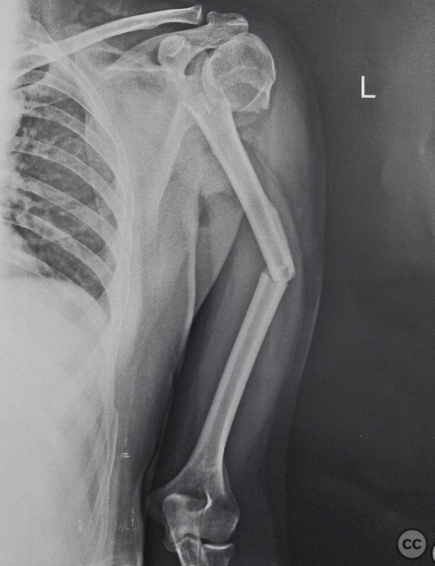 case image