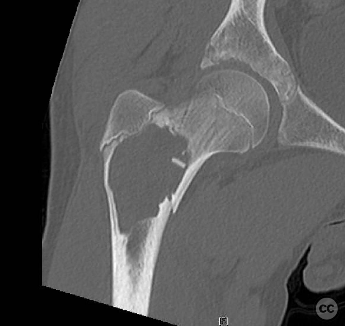 case image