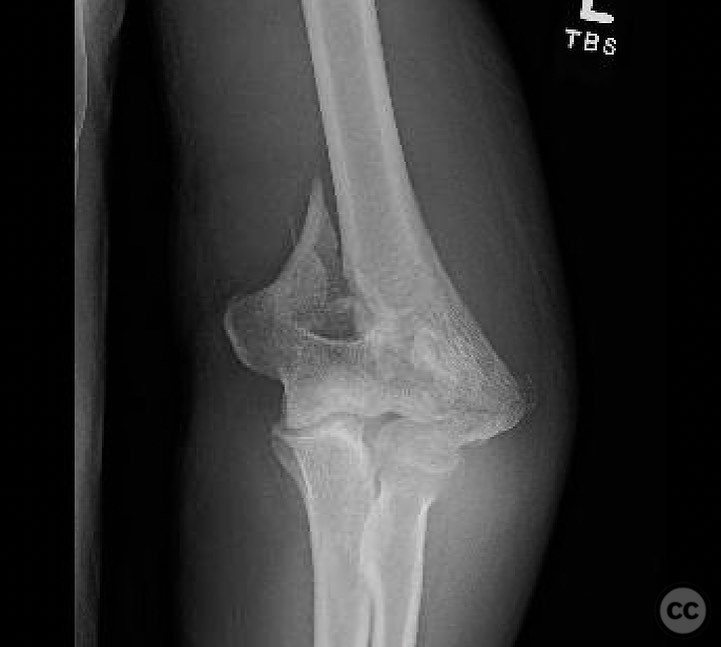 case image