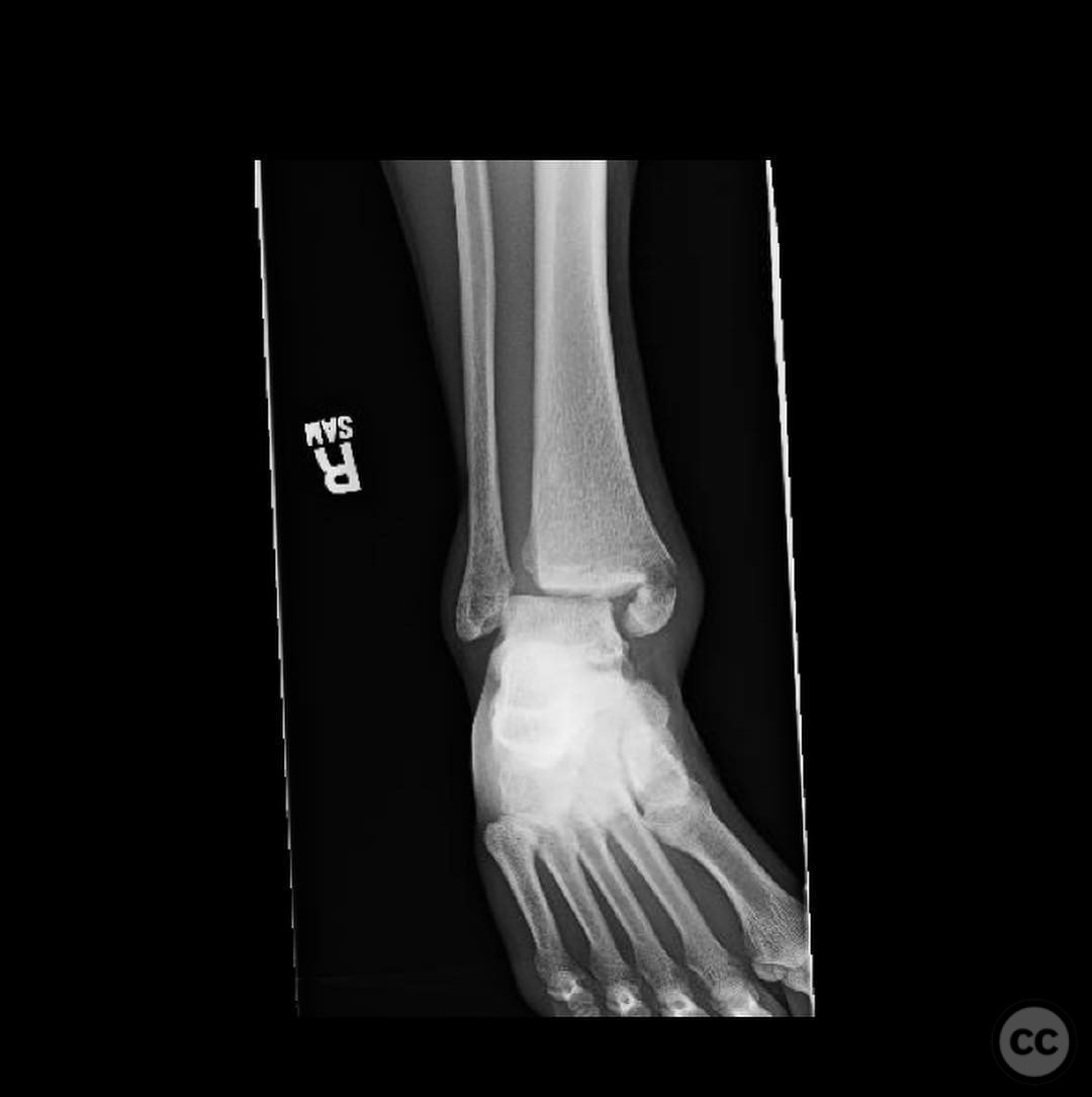 case image
