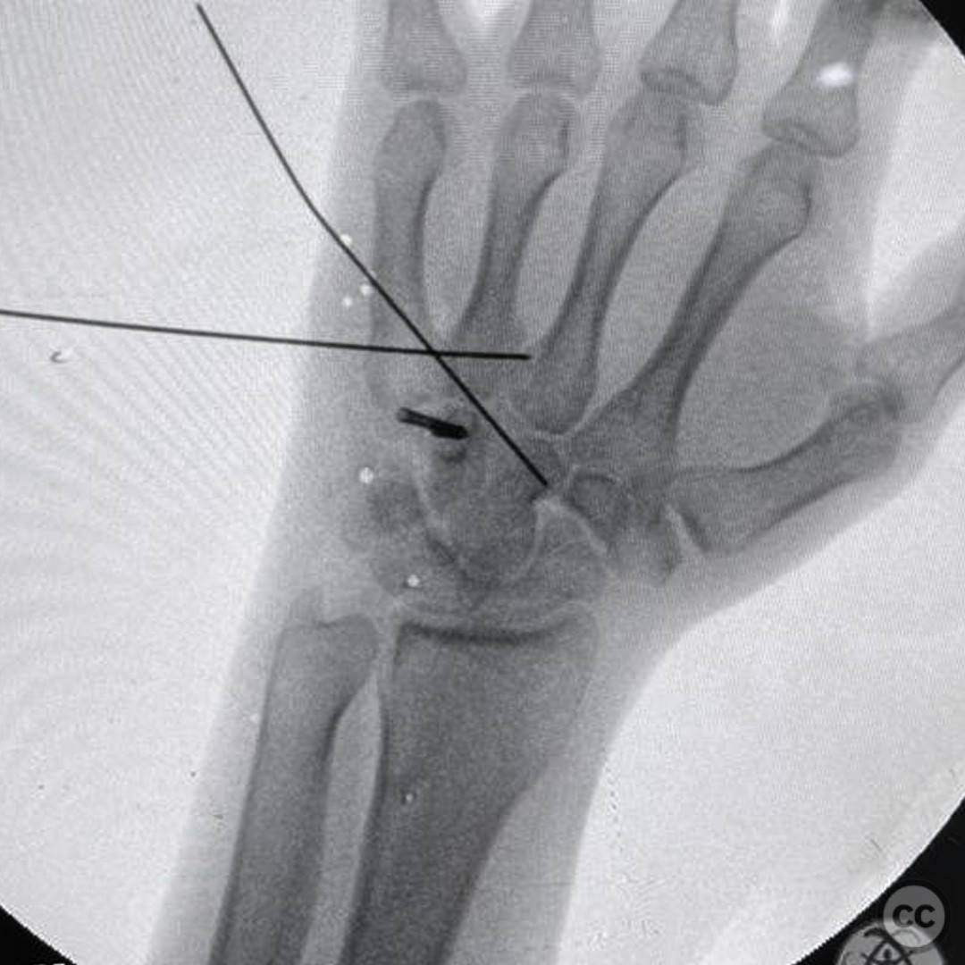 case image