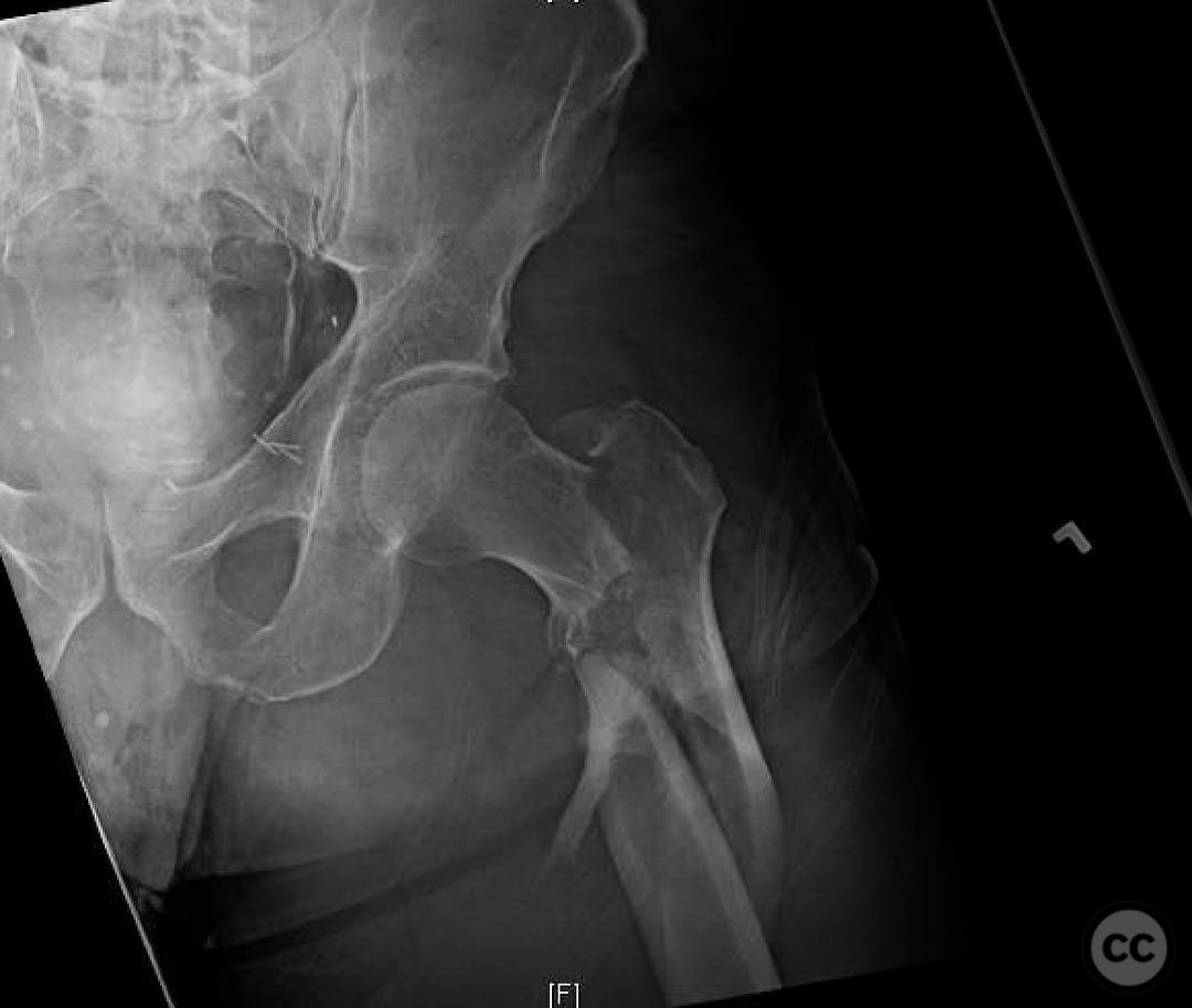 case image
