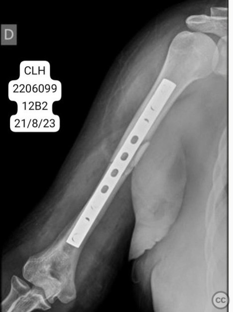 case image