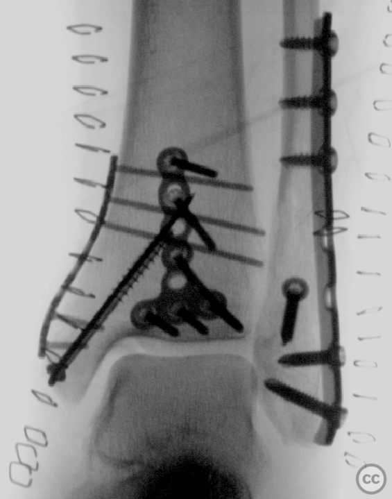 case image