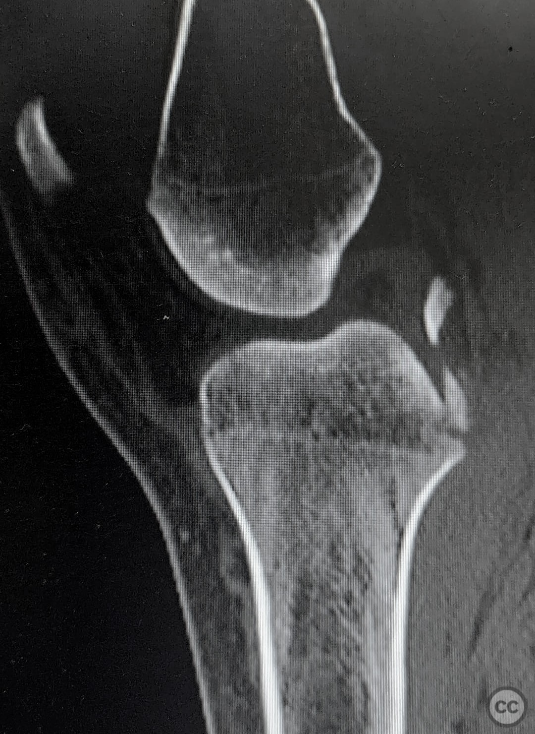 case image