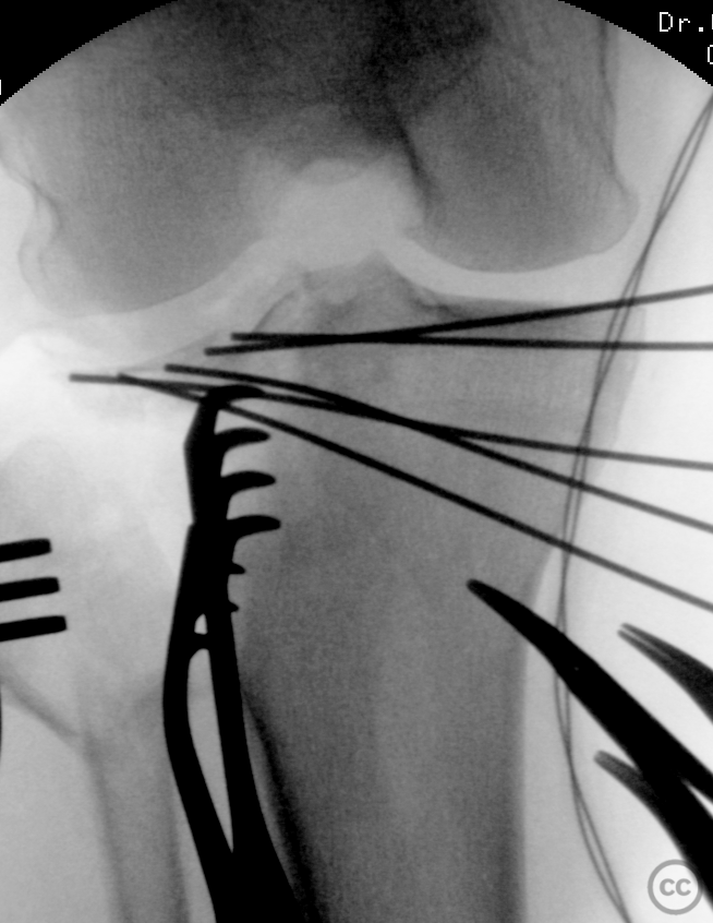 case image