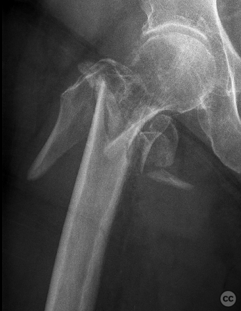 case image