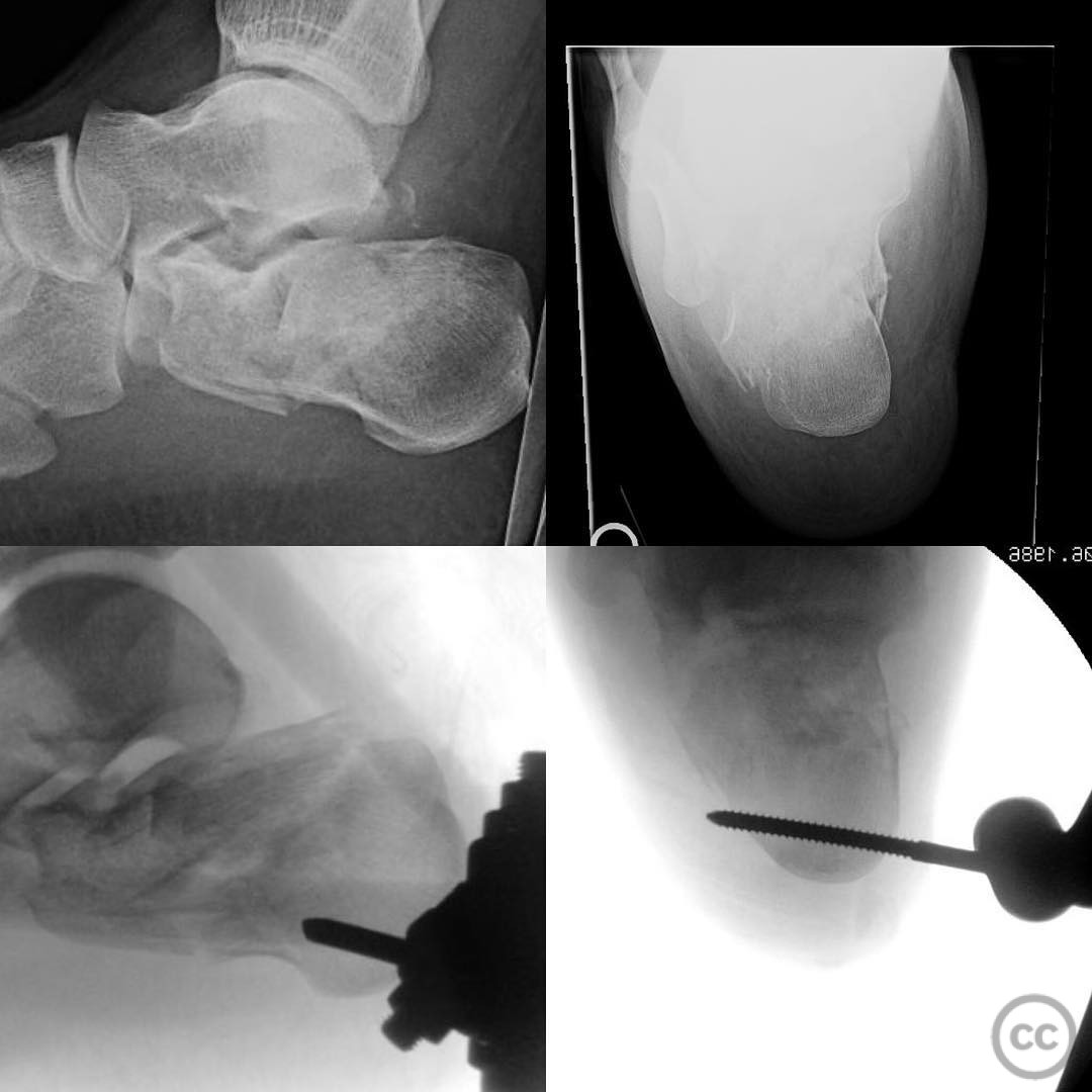 case image