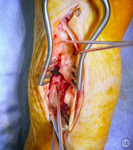case image