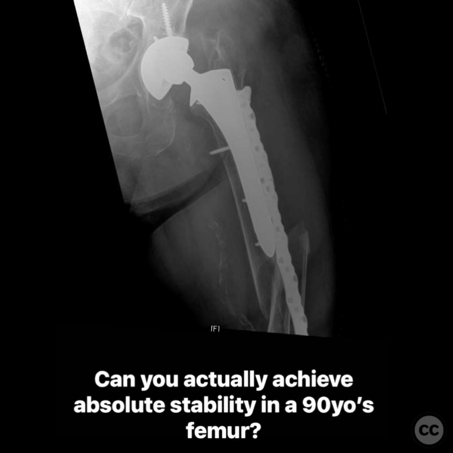 case image