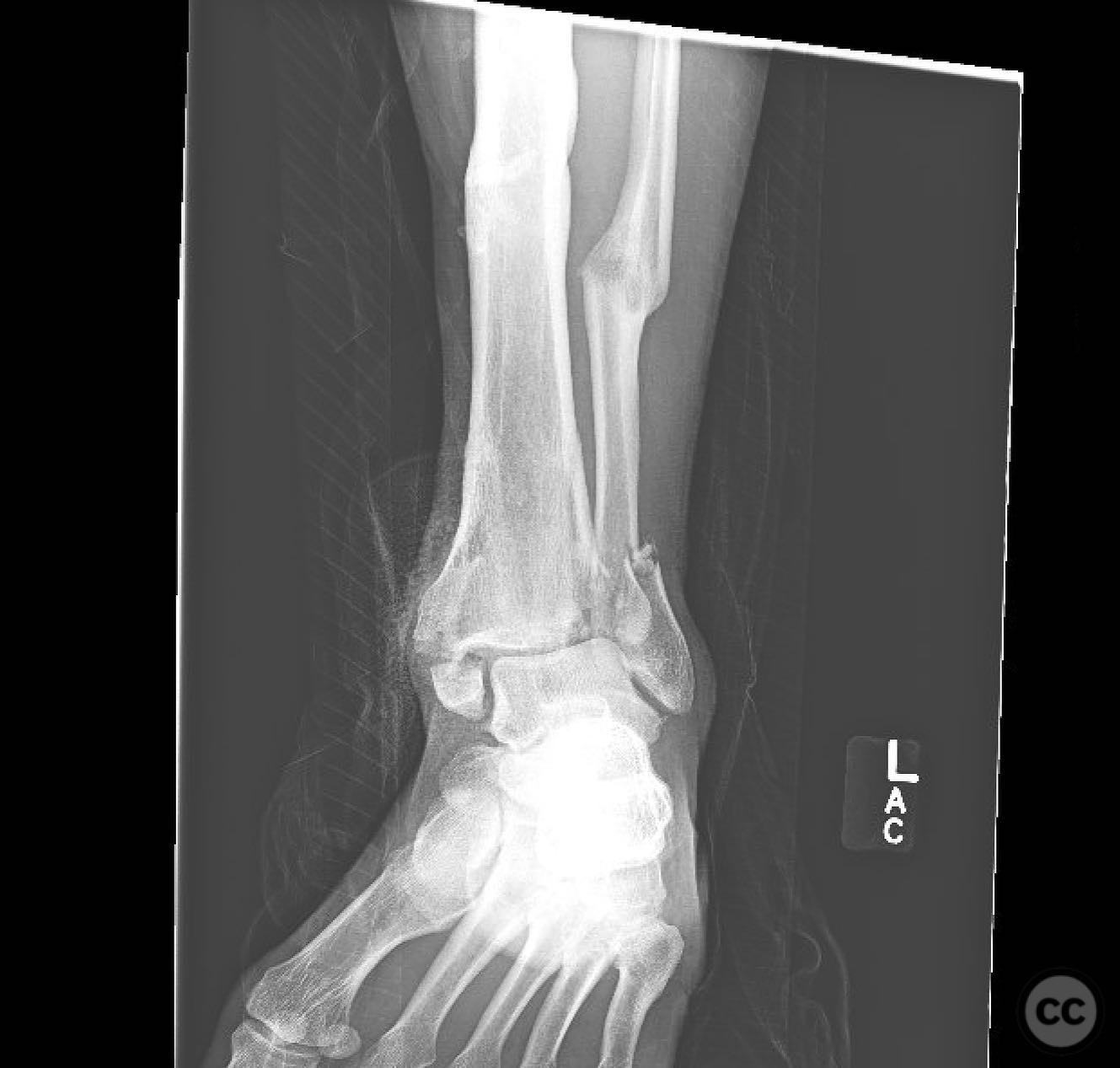 case image