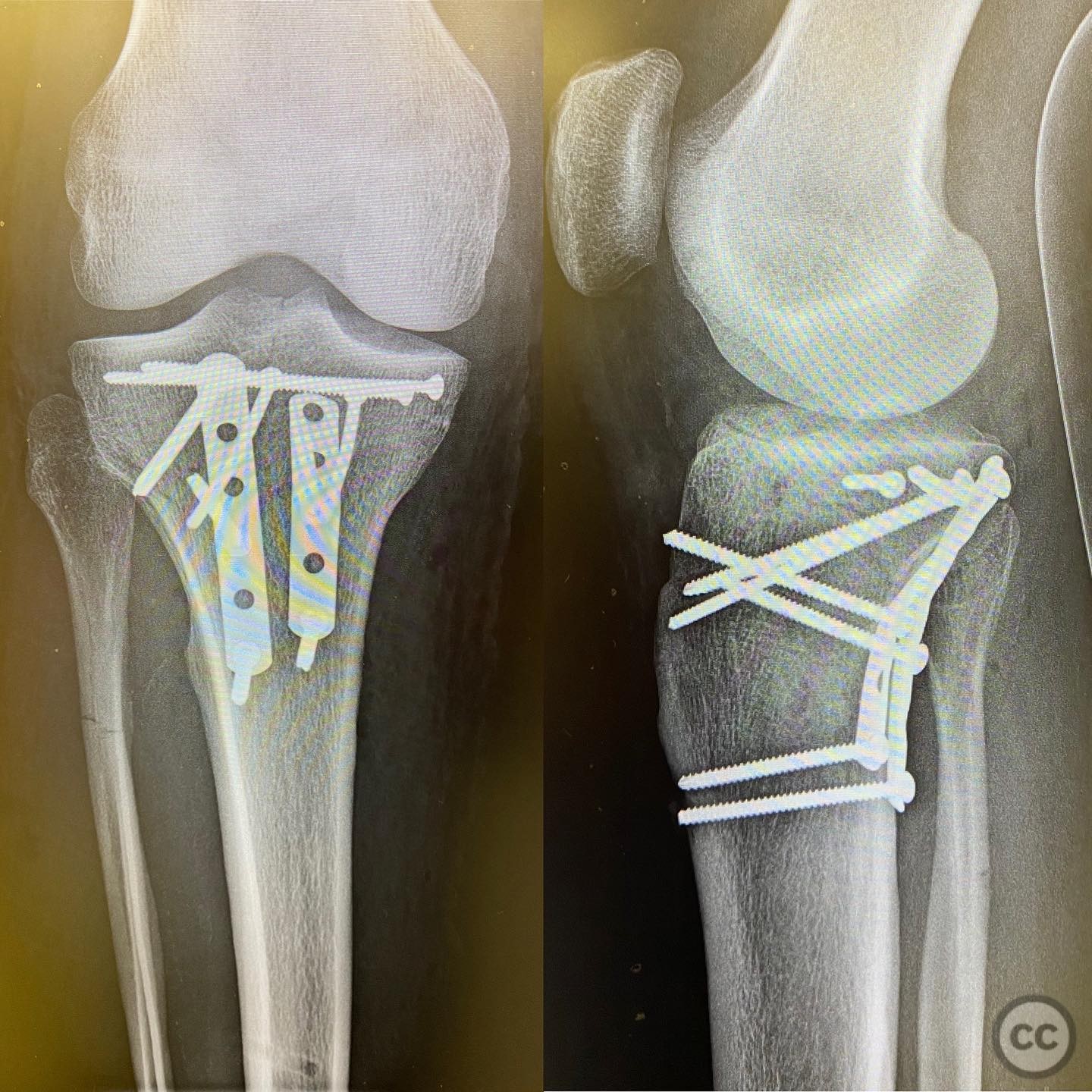case image