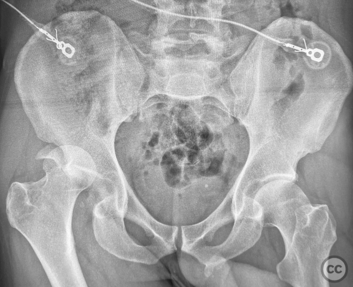 case image