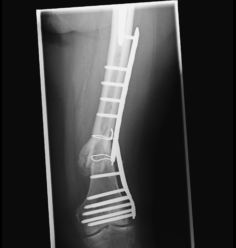 case image