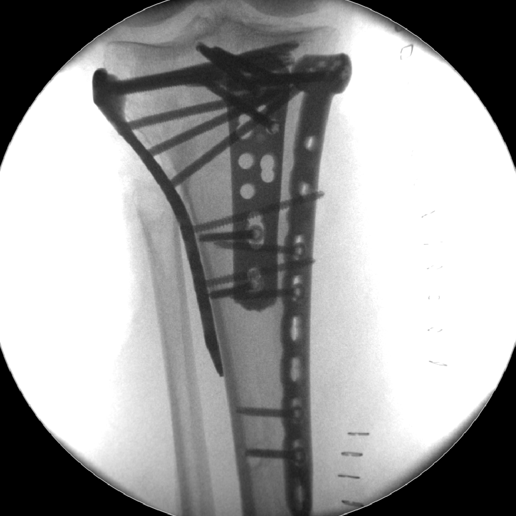 case image