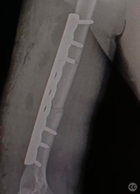 case image
