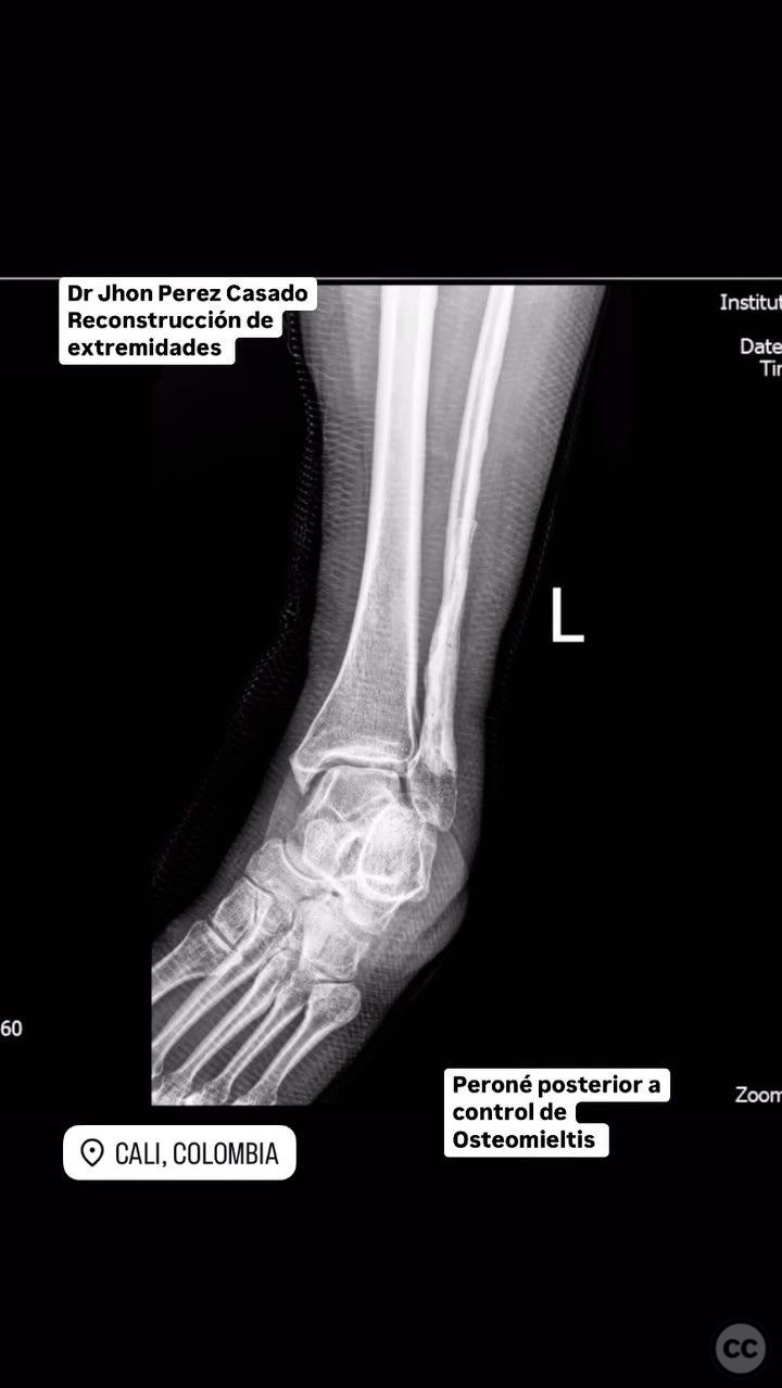 case image