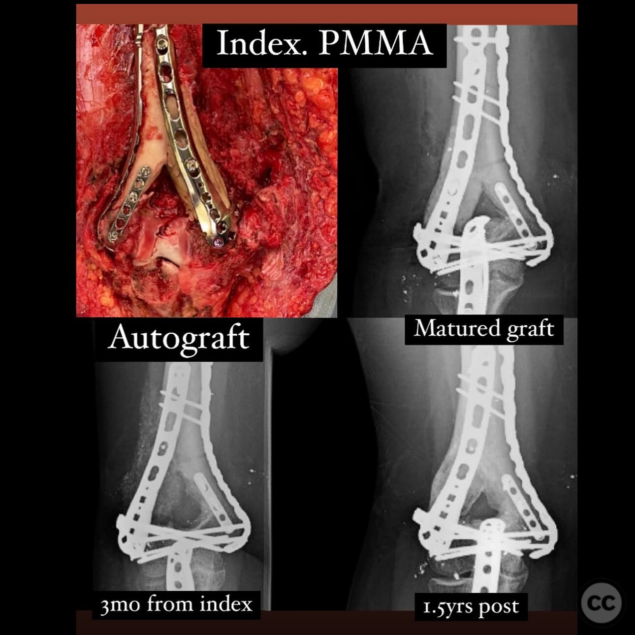 case image
