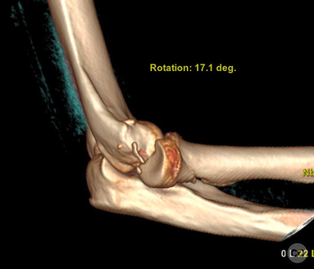 case image