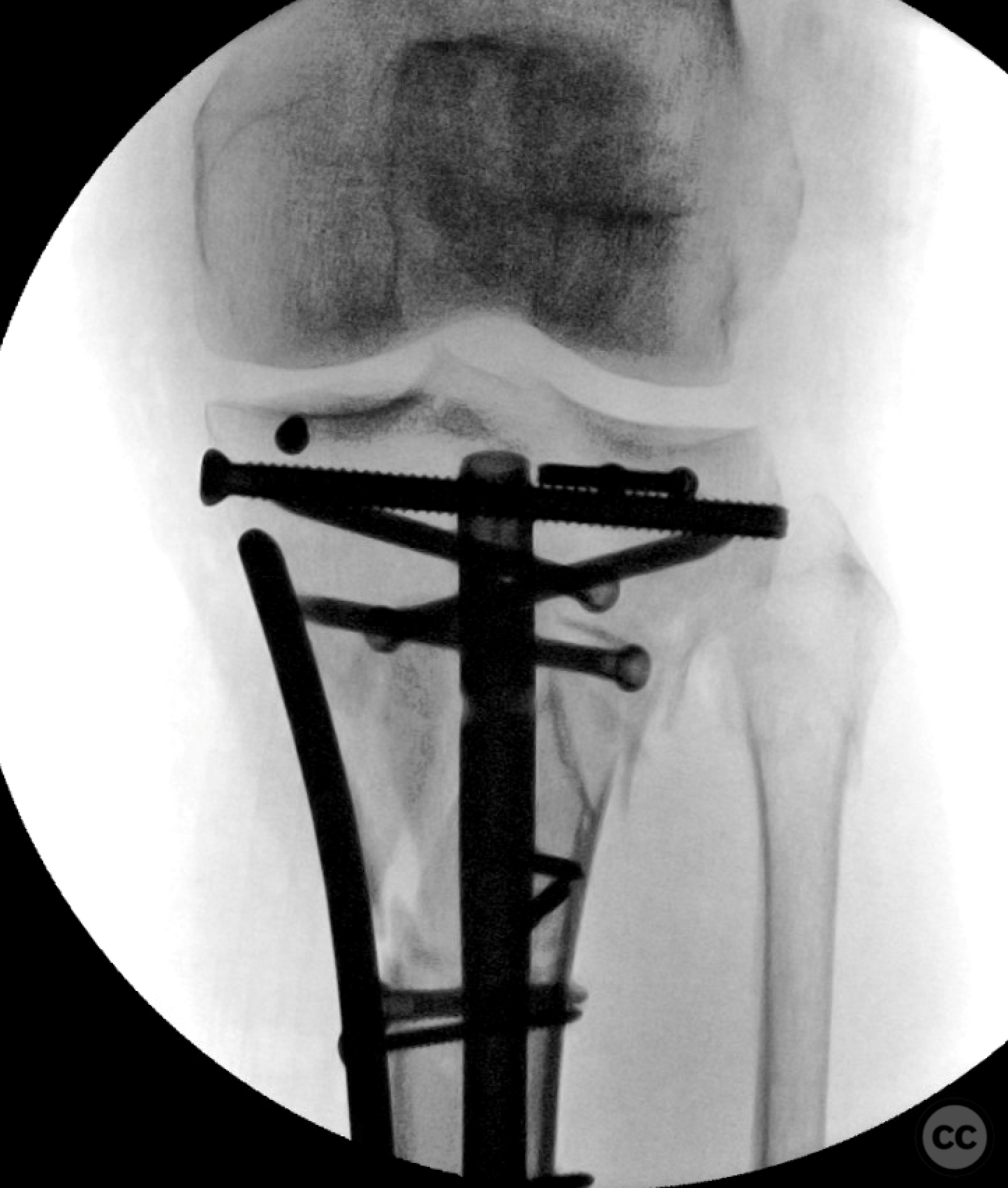 case image