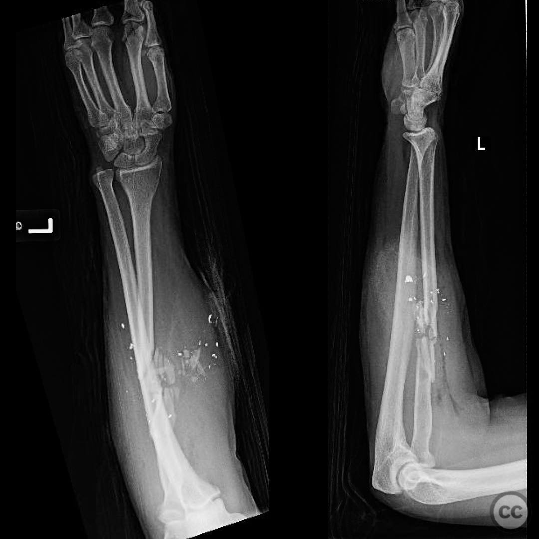 case image