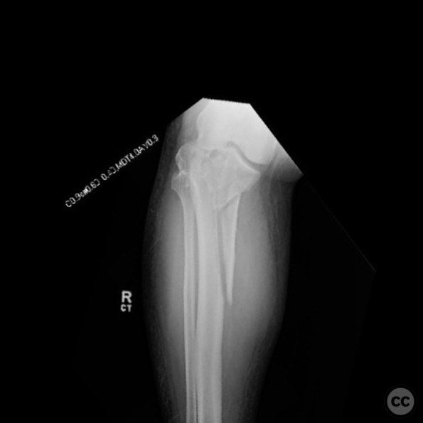 case image