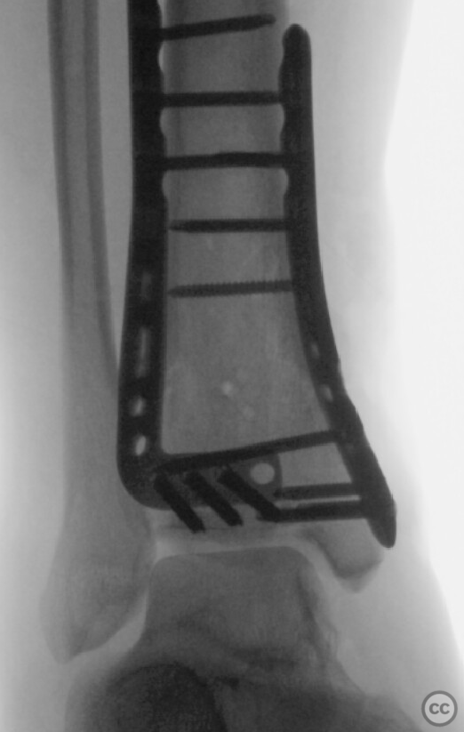 case image