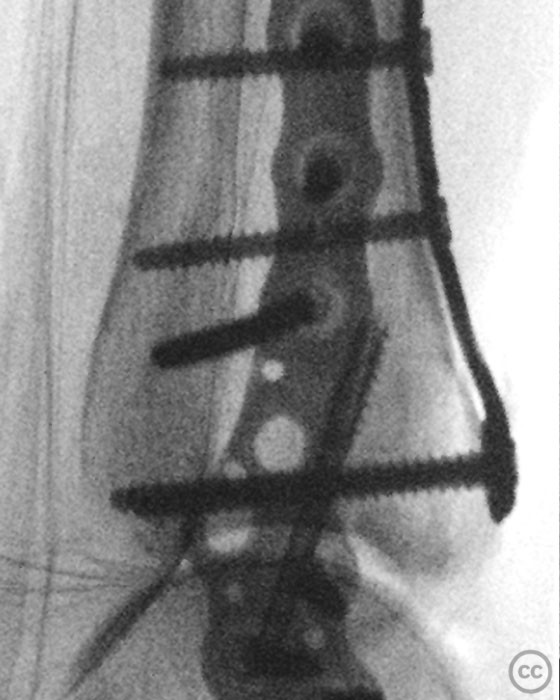case image