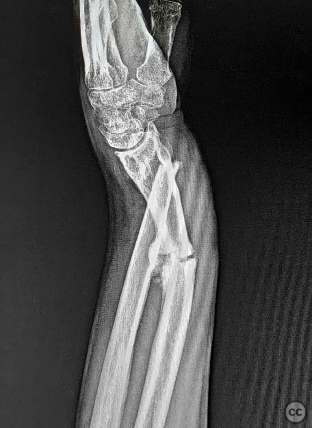 case image
